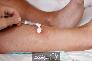 عوارض پوستی در کولیت اولسراتیو | پزشکت