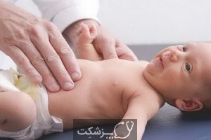علت استفراغ در نوزادان | پزشکت