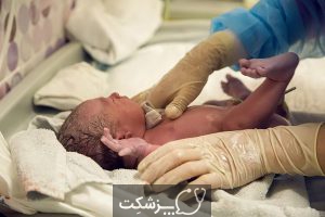 هیپوسپادیاس در نوزادان | پزشکت