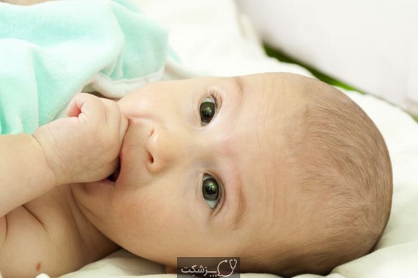 چسبندگی چشم در نوزادان | پزشکت