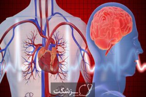فرق بین سکته مغزی با سکته قلبی؟ | پزشکت