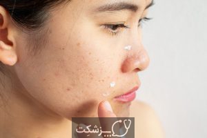 چگونه از پوست حساس مراقبت کنیم؟ | پزشکت