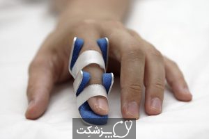 علت بی حسی انگشتان چیست؟ | پزشکت