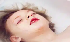 کف کردن دهان | پزشکت