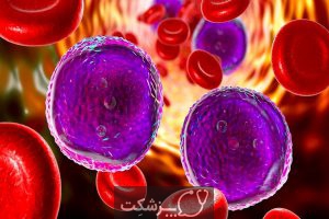 10 علائم خطرناک سرطان خون را بشناسید. 1 | پزشکت