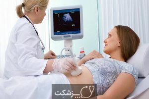 بارداری کاذب | پزشکت