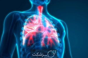 عفونت دستگاه تنفسی فوقانی، علت و علائم آن | پزشکت