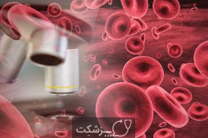 5 تفاوت عمده بین سرطان خون و لنفوم 1 | پزشکت