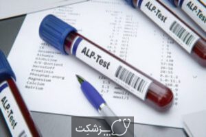 آزمایش ALP | پزشکت