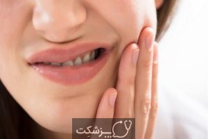 درمان دندان های حساس | پزشکت