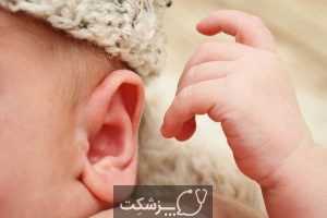 کاهش شنوایی در نوزادان | پزشکت