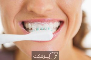 درمان دندان های حساس | پزشکت