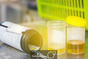 آزمایش 24 ساعته پروتئین ادرار | پزشکت