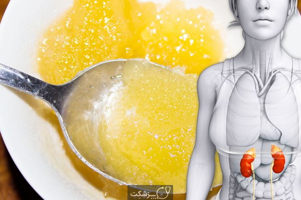 آیا دیابتی ها می توانند عسل بخورند؟ | پزشکت