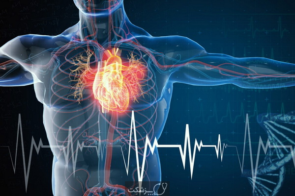 ایسکمی قلبی چیست و چگونه درمان می شود؟ | پزشکت