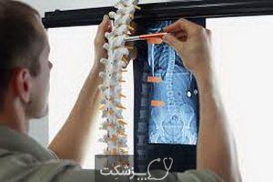 متاستاز استخوان، علل و علائم و راهکار درمانی آن چیست؟ | پزشکت