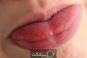 چگونه تورم جوانه چشایی را کاهش دهیم؟ | پزشکت