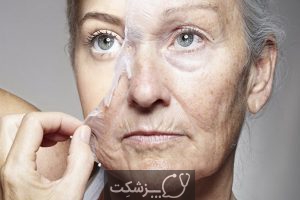10 روش برای کاهش پیری زودرس پوست | پزشکت