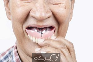 مشکلات دندانپزشکی در سالمندان | پزشکت
