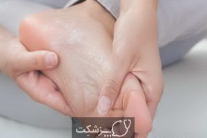 بیماری بری بری چیست؟ | پزشکت