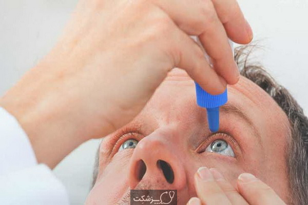 قطره کتورولاک چشمی چیست؟ | پزشکت