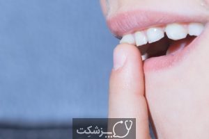 شایع ترین علت لق شدن دندان ها چیست؟ | پزشکت