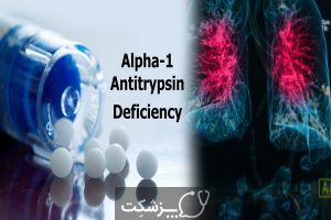 کمبود آلفا -1 آنتی تریپسین چیست؟ | پزشکت