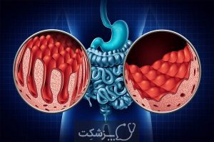 چرا مدفوع من بوی بد می دهد؟ | پزشکت