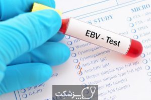 آزمایش آنتی بادی ویروس اپشتین بار (EBV) | پزشکت