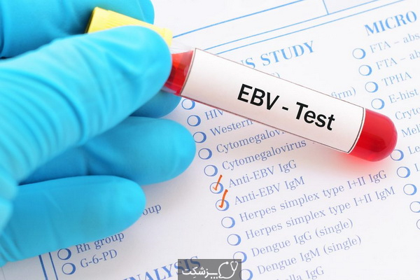 آزمایش آنتی بادی ویروس اپشتین بار (EBV) | پزشکت