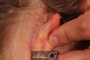 علت درد گوش بیرونی چیست؟ | پزشکت