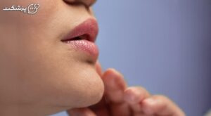 لرزش لب | پزشکت