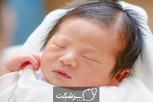 تاکی پنه گذرا در نوزاد تازه متولد شده | پزشکت
