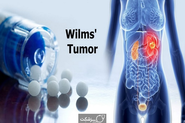 تومور ویلمز، علائم و راهکارهای درمانی آن کدامند؟ | پزشکت
