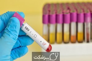 آزمایش آنتی بادی ویروس اپشتین بار (EBV) | پزشکت