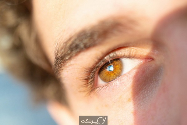 آفتاب سوختگی چشم چیست؟ | پزشکت