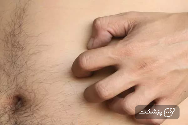 علت ارش شکم