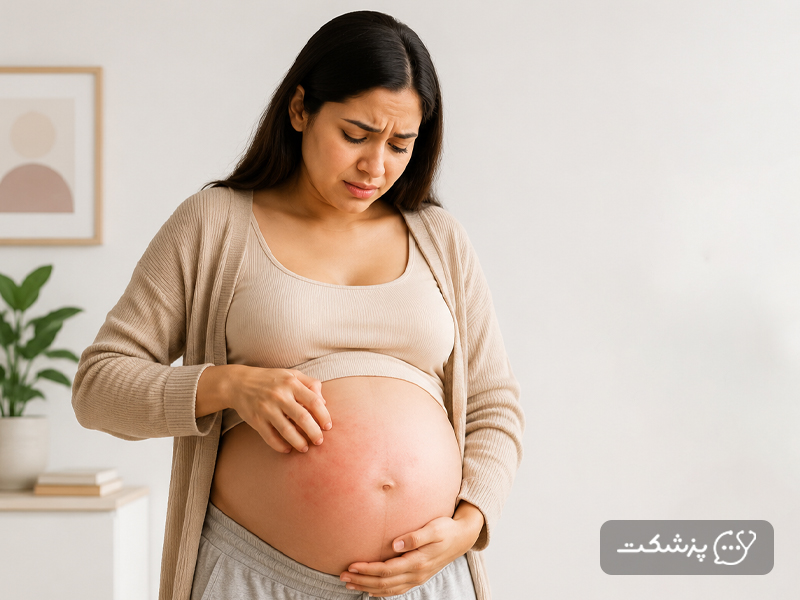 خارش شکم در زن باردار