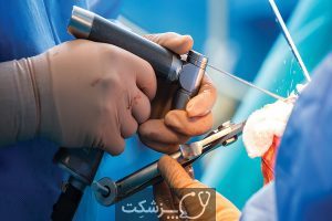 جراحی ارتوپدی چیست؟ | پزشکت