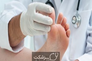 شکستگی انگشت پا چیست و چگونه درمان می شود؟ | پزشکت