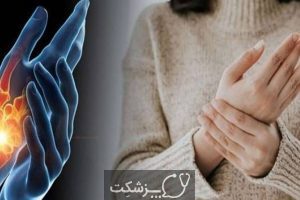 چگونه اسید اوریک بدن را کاهش دهیم؟ | پزشکت