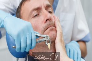 خرد شدن دندان های عقل و راهکارهای آن | پزشکت