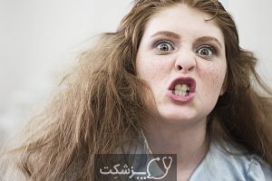 بی ادبی نوجوانان، باید ها و نباید در برخورد با آنها | پزشکت