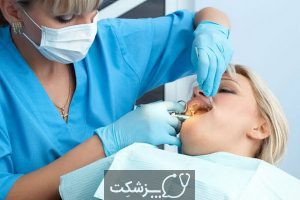انواع روش های جراحی دندان کدامند؟ | پزشکت