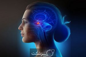 پرولاکتینوما (Prolactinoma) از علل تا عوارض آن | پزشکت