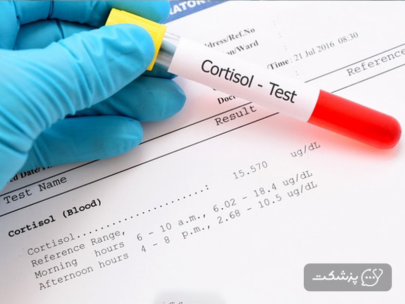 آزمایش خون کم کاری هیپوفیز