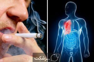 بعد از ترک سیگار چه اتفاقی در بدن می افتد؟ | پزشکت