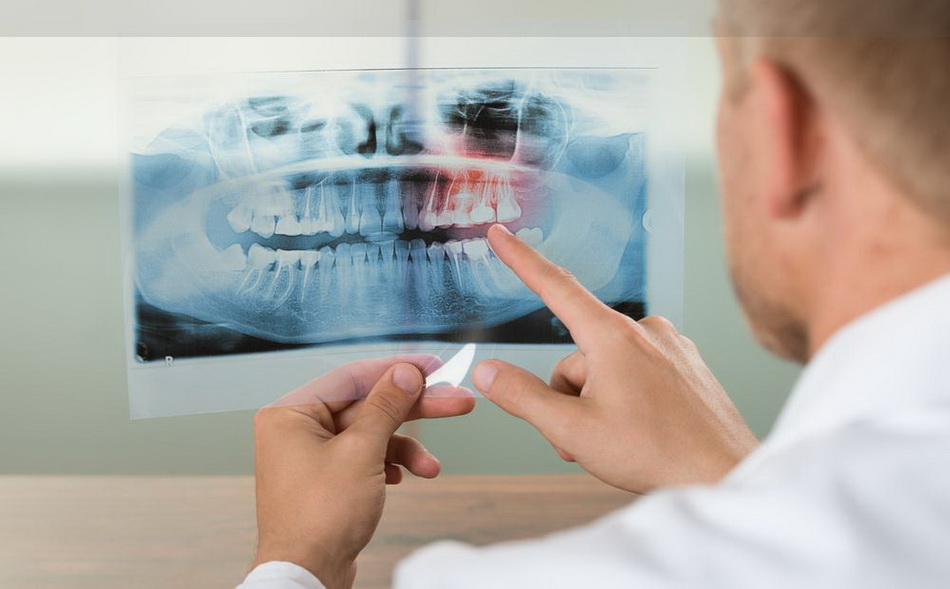 اشعه ایکس دندان چگونه انجام می شود؟ | پزشکت