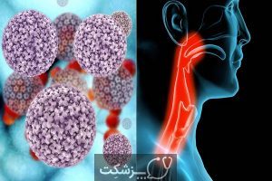 ویروس پاپیلومای انسانی (HPV) و سرطان | پزشکت