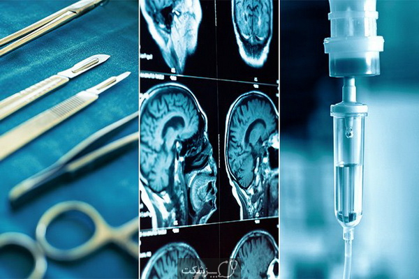 درمان تومور مغزی | پزشکت